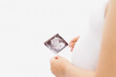 孕期要做几次四维彩超?