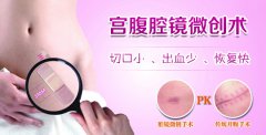 警示：出现这些症状，小心是子宫肌瘤!